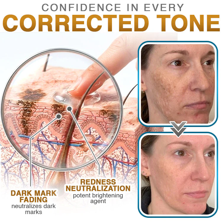 𝗖𝗮𝗿𝗲𝗕𝗿𝗲𝗲𝘇𝗲® 100% Silicone Scar Cream Formula 👨‍⚕️ - Image 5