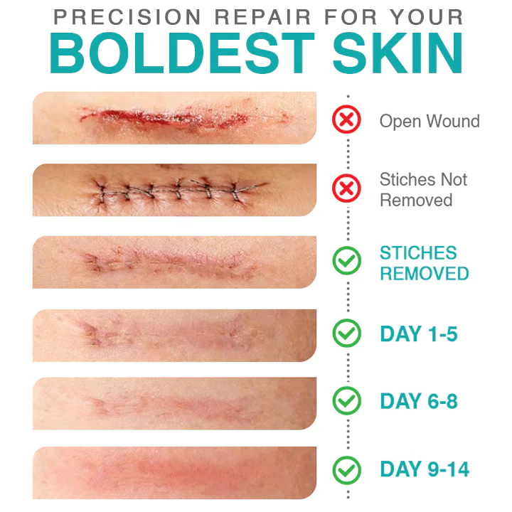 🥼 𝗖𝗮𝗿𝗲𝗕𝗿𝗲𝗲𝘇𝗲® 3-in-1 Microneedle Care Patch - Image 5