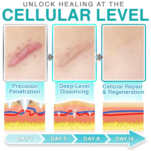 4pcs x 𝗖𝗮𝗿𝗲𝗕𝗿𝗲𝗲𝘇𝗲® Microneedle Scar Care Patch - Image 9