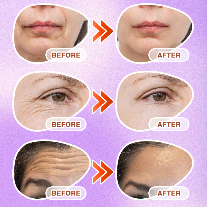 𝘾𝙖𝙧𝙚𝘽𝙧𝙚𝙚𝙯𝙚® Microneedle Anti-Aging Care Patch - Image 4