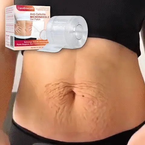 ✅ CareBreeze® Anti-Cellulite Microneedle Patch - Image 3