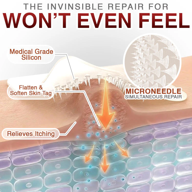 CareBreeze® Skin Tag Removal Micro-needle Patch - Image 4
